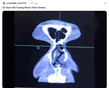 a ct scan of a person 's nose with the caption " 20 years old turning red in the cinema "