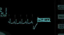 a monitor shows a heartbeat and says filter on the top left