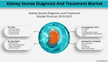 a poster showing kidney stones diagnosis and treatment market