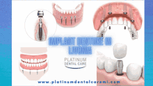 an advertisement for platinum dental care shows a picture of a denture