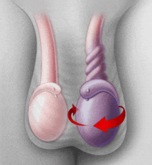 a drawing of a man 's testicles with a red arrow pointing to the left testicle