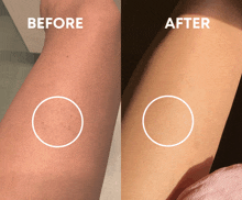 a before and after photo of a person 's arm with circles on it