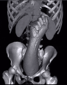 a black and white image of a skeleton with a fist in the middle