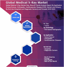 a poster titled global medical x-ray market showing a doctor looking at a picture