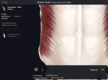 a screen shows the motion mode of the psoas minor muscle ( right )