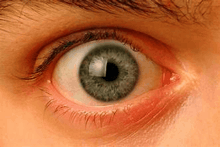 a close up of a man 's green eye with a red eyelid and a white pupil .