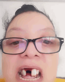 a woman wearing glasses shows off her teeth