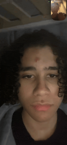 a young man with a red spot on his forehead is on a video call