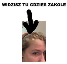 a picture of a woman 's face with an arrow pointing to her forehead and the words widzisz tu gdzies zakole below