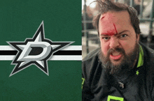 a man with a beard has blood on his face next to a star logo