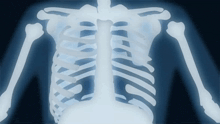 an x-ray of a skeleton shows the ribs and shoulder bones