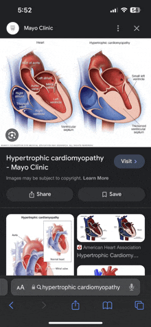 a phone screen shows a picture of a heart and says mayo clinic