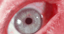 a close up of a person 's blue eye