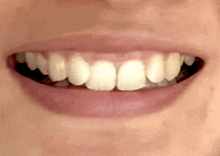 a close up of a person 's mouth with white teeth .