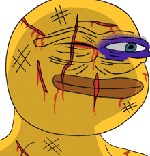 a cartoon drawing of a yellow face with blood coming out of it and a purple eye