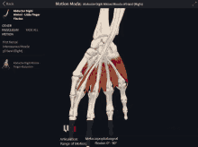 a screenshot of a hand shows the abductor digiti minimini muscle of the hand