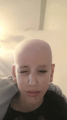 a person with a shaved head looks at the camera