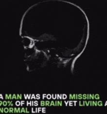 a picture of a skull with the words " a man was found missing 90 % of his brain yet living a normal life " below it