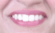 a close up of a woman 's teeth with pink lips