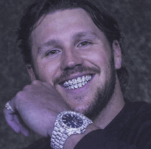 a man with braces and a watch on his wrist smiles
