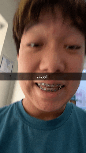 a young man with braces on his teeth says yayy