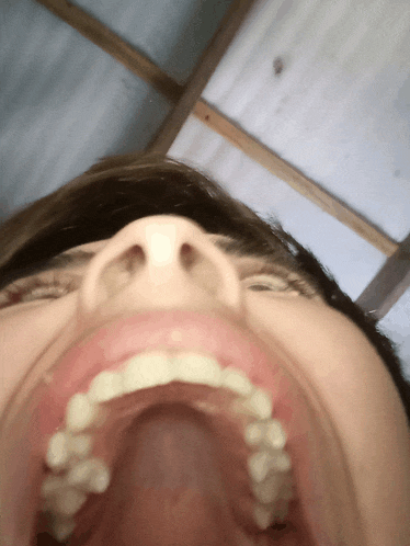 a close up of a person 's mouth with their teeth visible