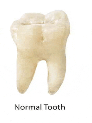 a normal tooth is shown on a white background with the words `` normal tooth '' below it .