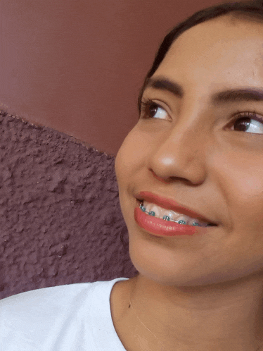 a young woman with braces on her teeth smiles for the camera