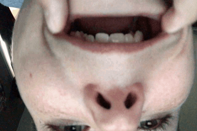 a close up of a person 's face with their mouth open showing their teeth