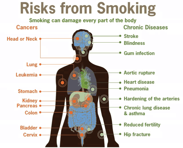 a diagram showing the risks from smoking and the chronic diseases