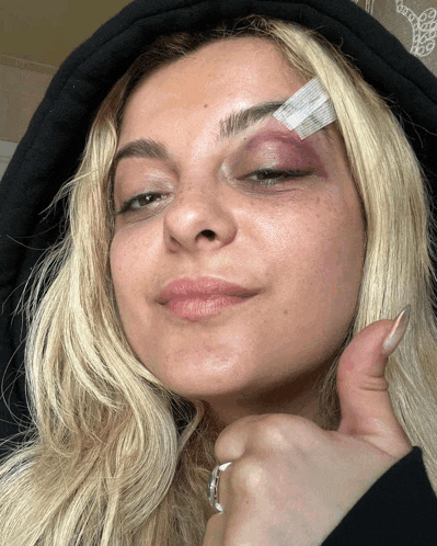 a woman with a bandage on her eye giving a thumbs up sign