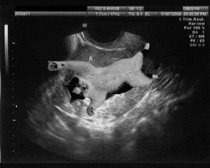 a black and white ultrasound image of a cat in a woman 's uterus