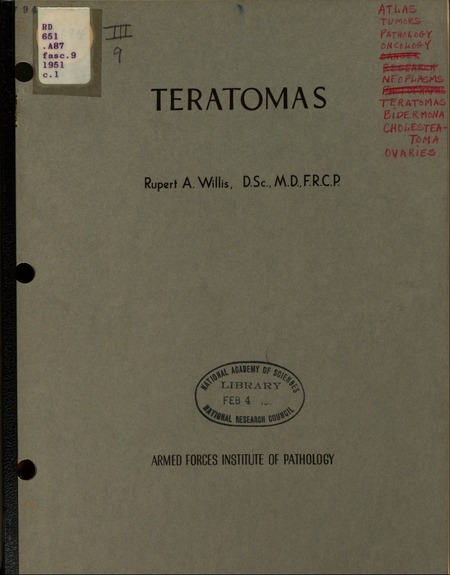 Teratomas