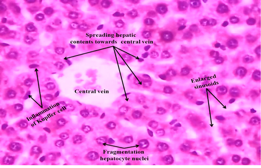 Liver Histology Kupffer Cells