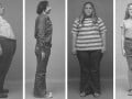 Can Morbid Obesity Be Reversed Through Diet?