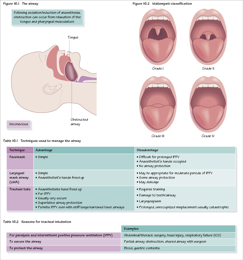 Intubation Airway View