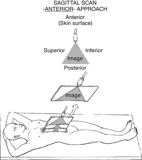 Longitudinal Plane Of The Body