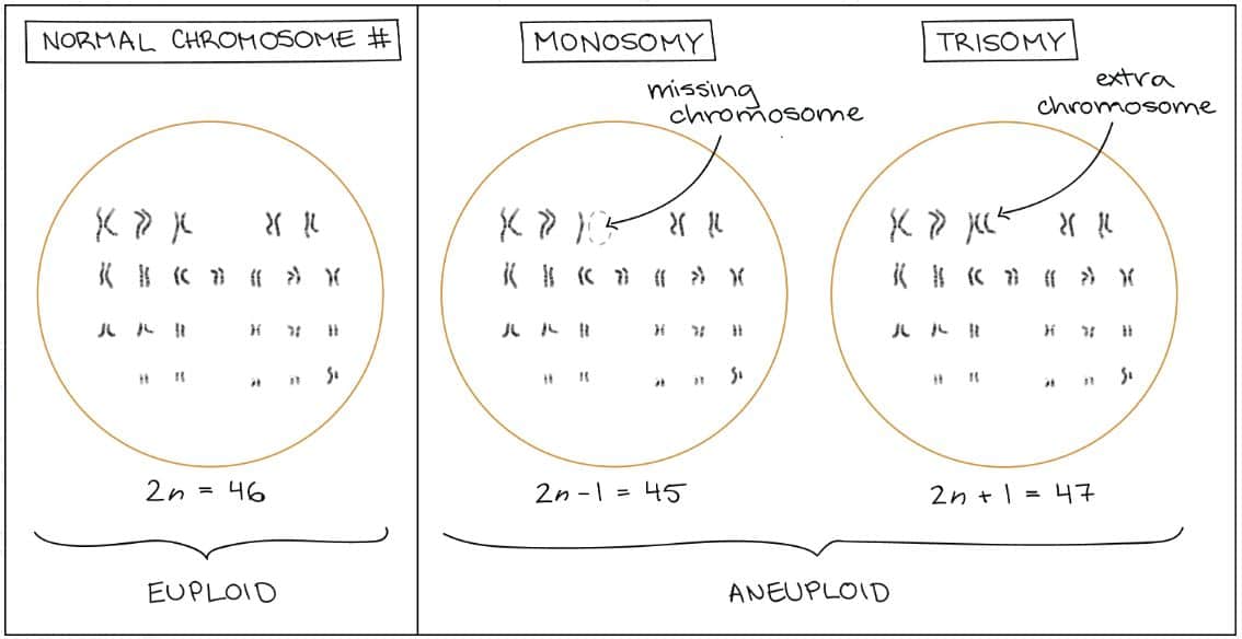 Common types of aneuploidy