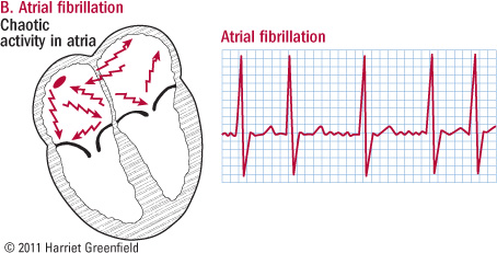 ECG-acquisition-classification