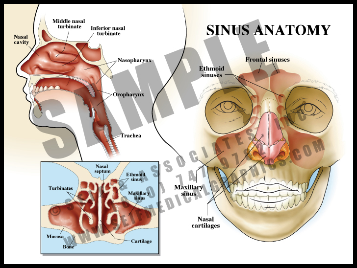 Sinusitis Diagram | lupon.gov.ph