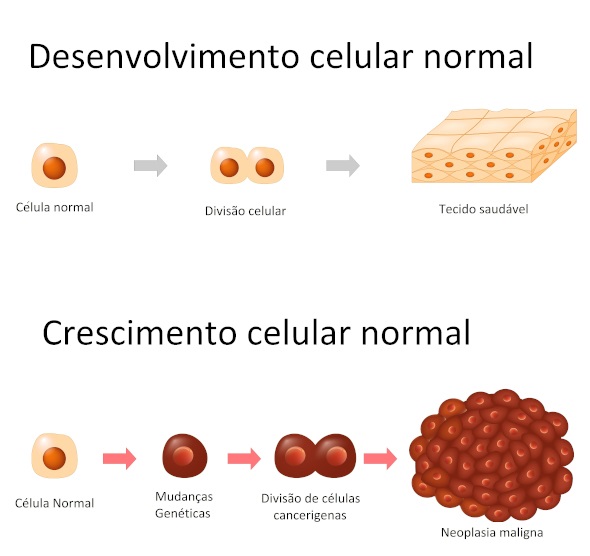 Nas neoplasias, as cÃ©lulas sofrem alteraÃ§Ãµes e a sua proliferaÃ§Ã£o passa a ser desordenada.