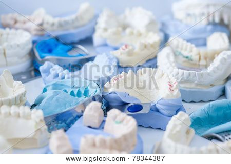 Dental Plaster Moulds And Imprints