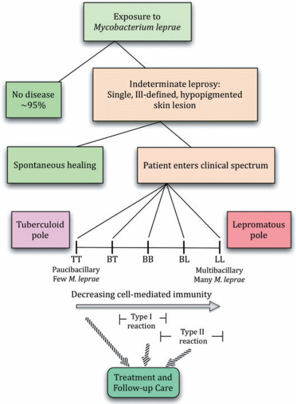 Stages in Leprosy infection